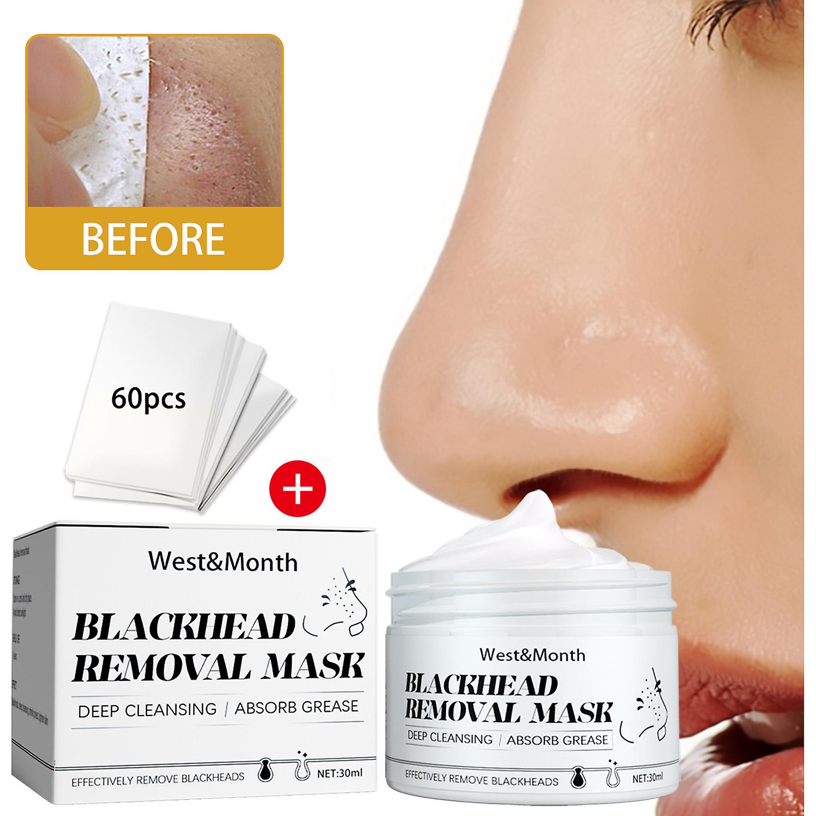 Peelable Blackheads Nasal Membrane T-zone Care Acne Removal Blackheads Shrinkage Pores Nasal Patches