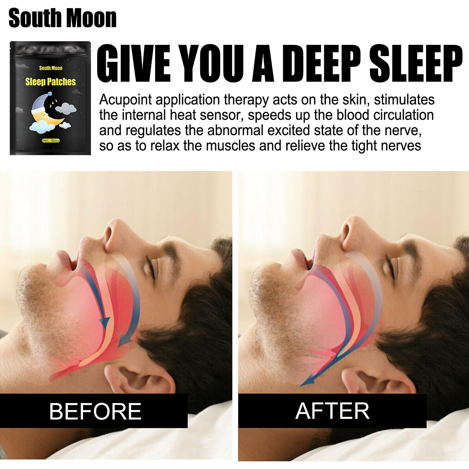 Help Sleep Patch Improve Dreaminess Fast Sleep Acupuncture Point Pressure Stimulation Patch