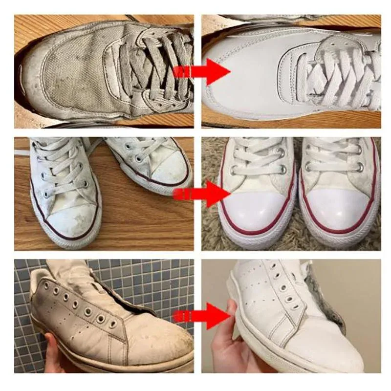 🔥 BIG SALE - 49% OFF🔥  Buy 1 Get 3 Free - GochicgoldenTM Shoes W