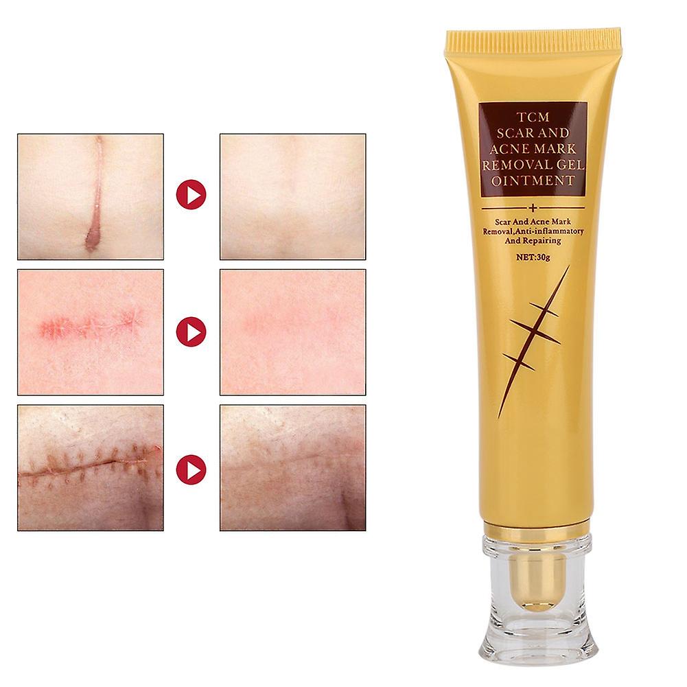 30g Acne Mark Scar Removal Gel Face Body Skin Repair Gel Anti Scar Stretch Marks Treatment