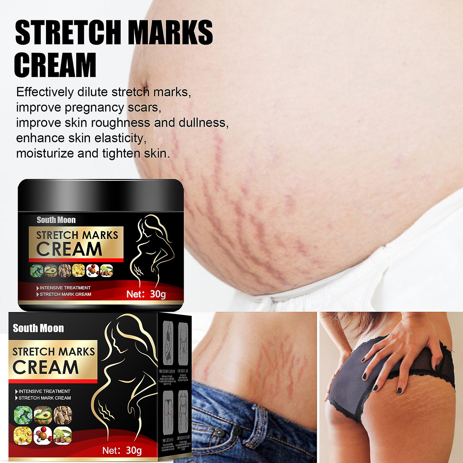 Skin Pregnancy Firming Repair Cream Postpartum Wrinkle Removal Lightening Growth Lines Obesity Lines Wrinkles Repair