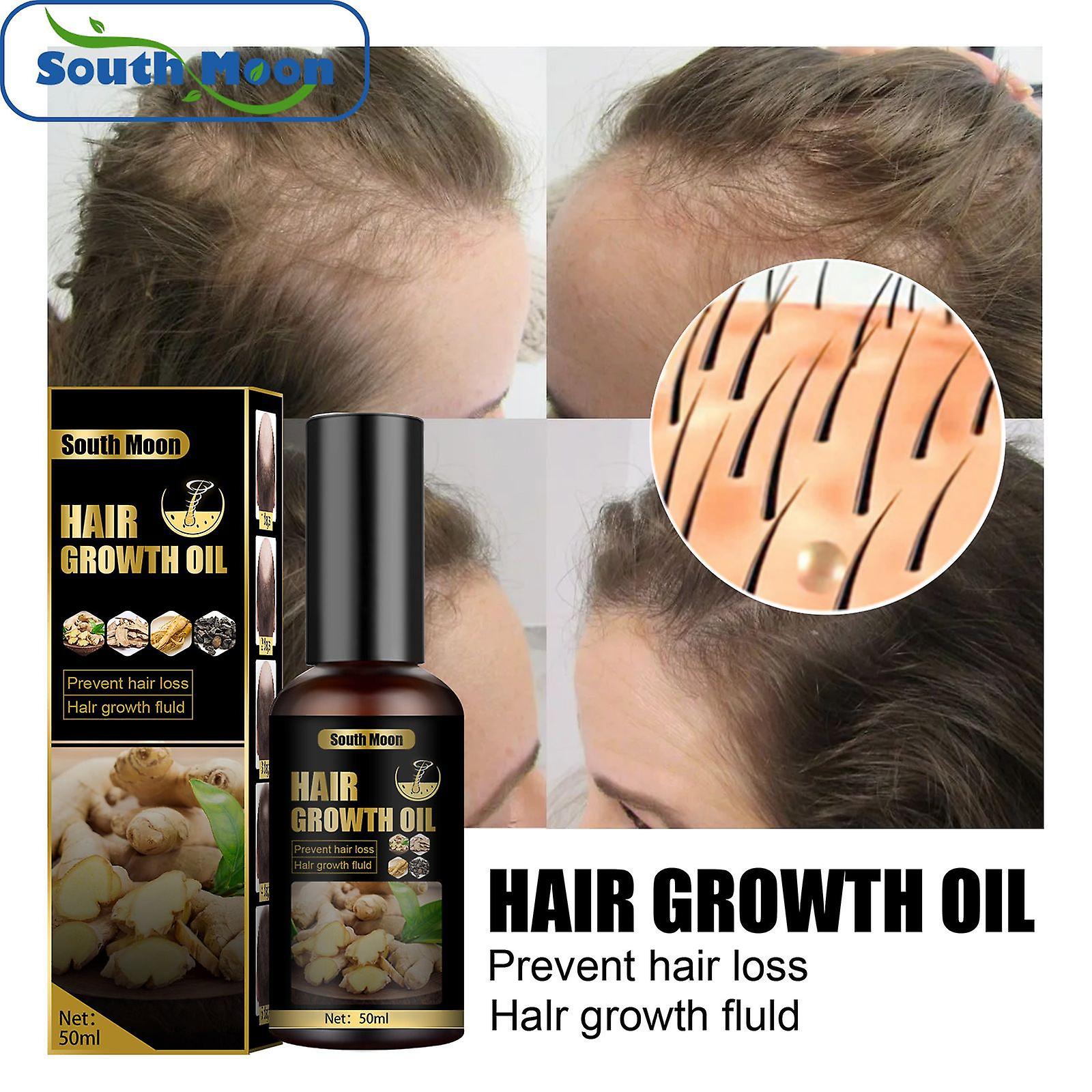 Prevents Hair Growth Fluid Strengthens Hair Thickens Hair And Densifies Hair Nutrition Growth Fluid