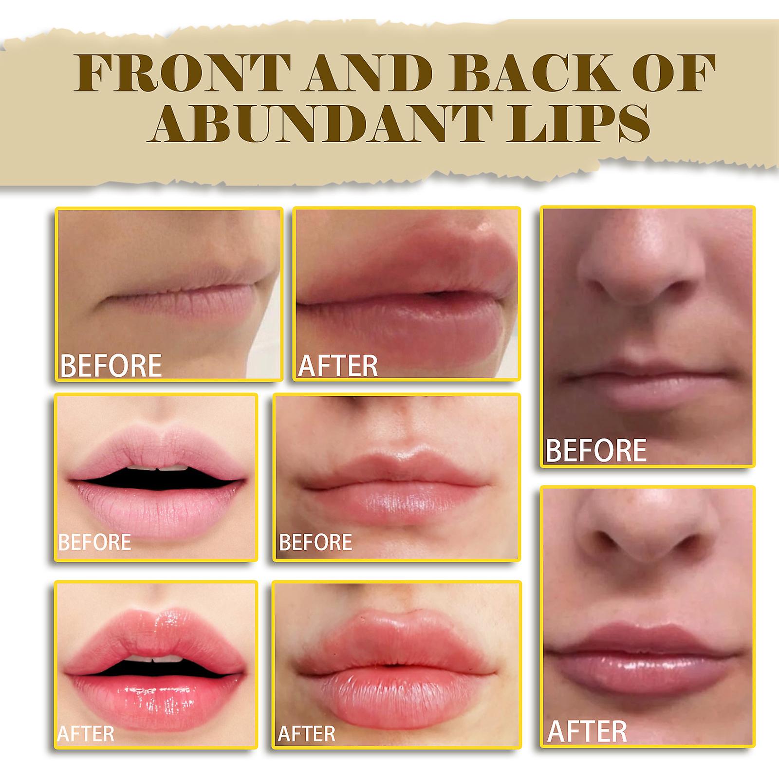 Lip Essence Lip Essence Lip Removal Dead Skin Tender Lip Removal Black Lip Color Lighten Lip Lines And Moisturize