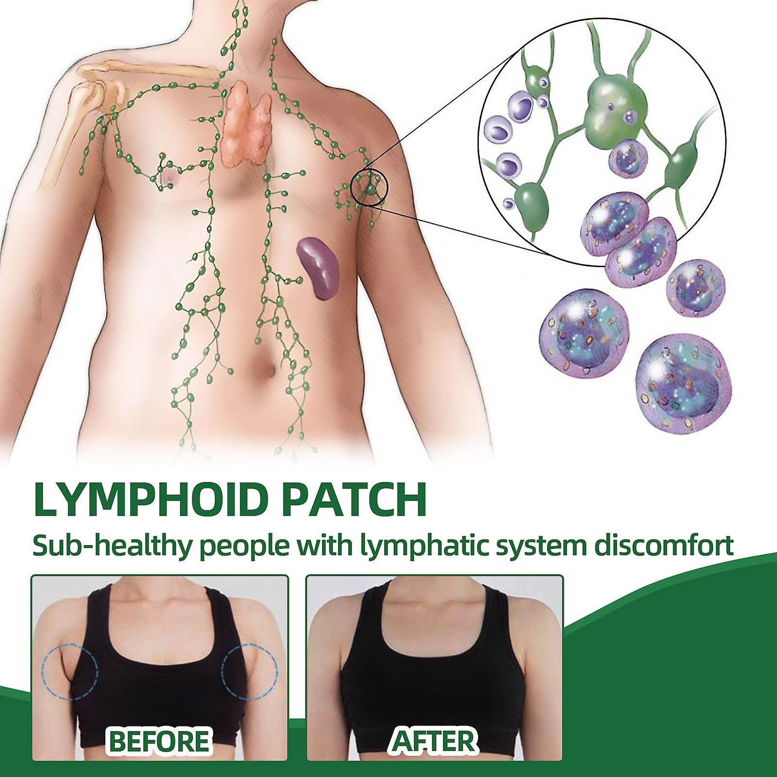 Lymphatic Patch Cervical Nodules Inguinal Groin Armpitary Paramammary Lymphatic Patch Dredging Lymph