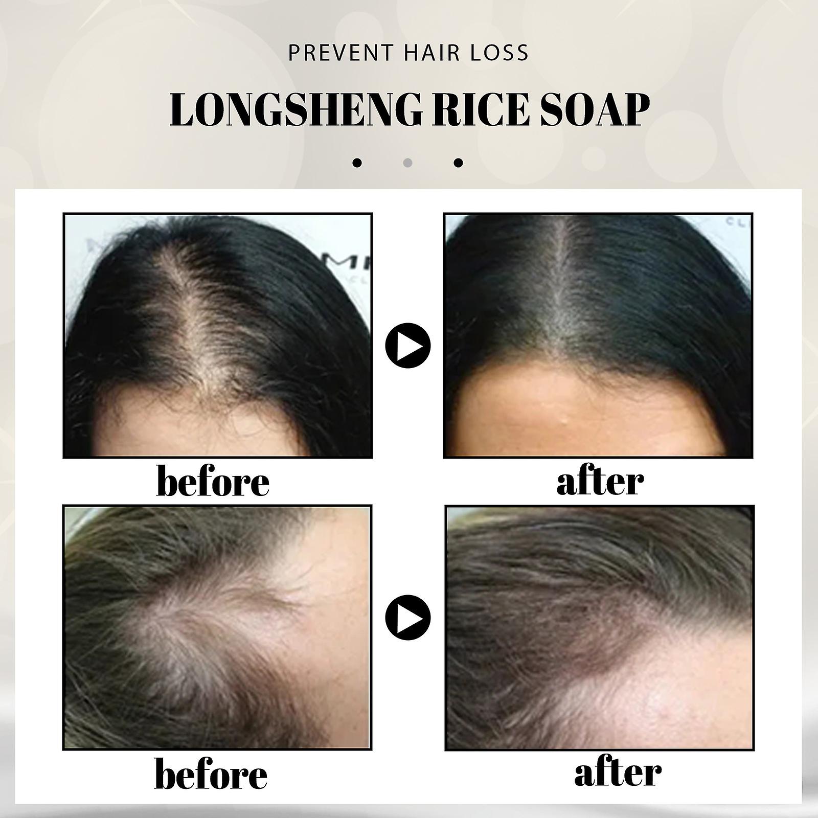 Longsheng Rice Shampoo Soap Refreshing Scalp Cleansing And Nourishing Hair Softening Longsheng Rice Handmade Soap