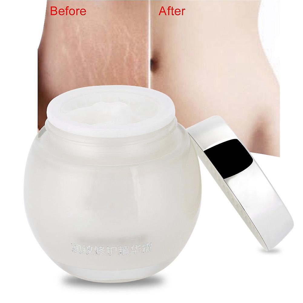 Stretch Mark Removal Repair Body Cream Skin Moisturzing Whitening For Pregnancy Women