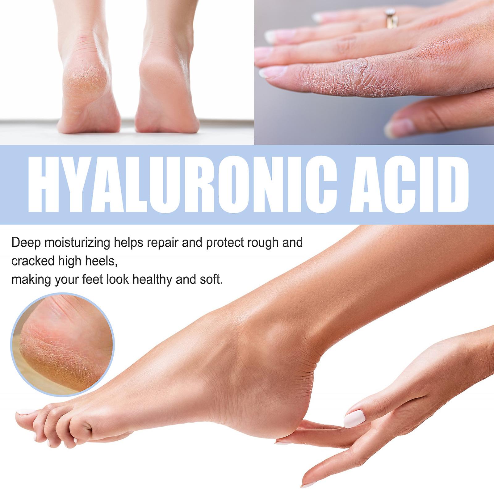 Hyaluronic Acid Anti-cracking Antifreeze Cream Hyaluronic Acid Essence Moisturizing And Moisturizing Anti-cracking Exfoliating Cream