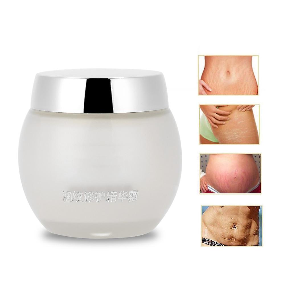 Stretch Mark Removal Repair Body Cream Skin Moisturzing Whitening For Pregnancy Women