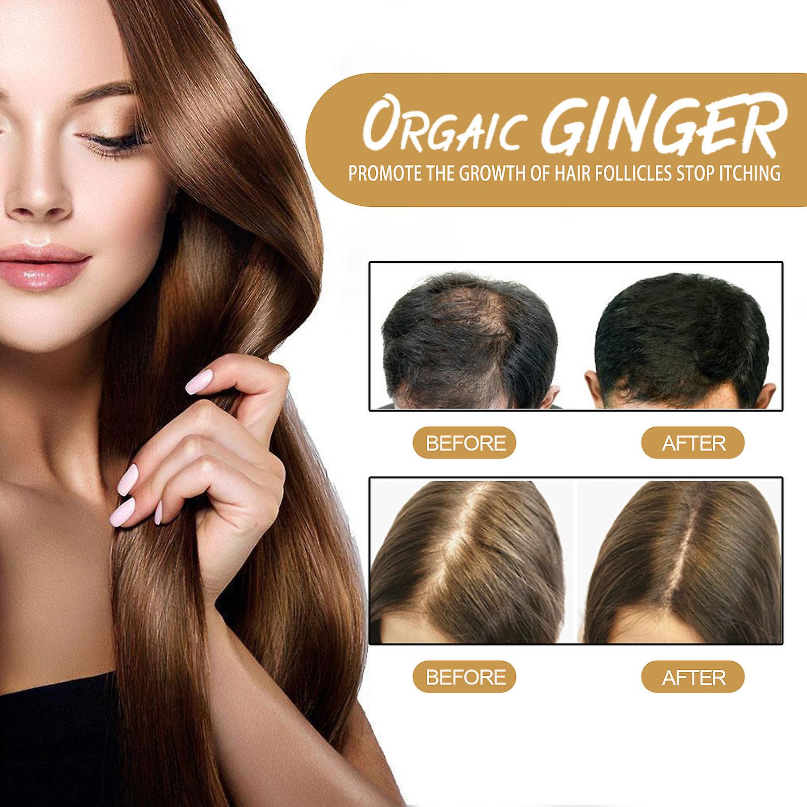 Ginger Shampoo Soap Anti-off Hair Care Scalp Cleansing Shampoo Grows Dense Hair Moisturizes And Supples Hair