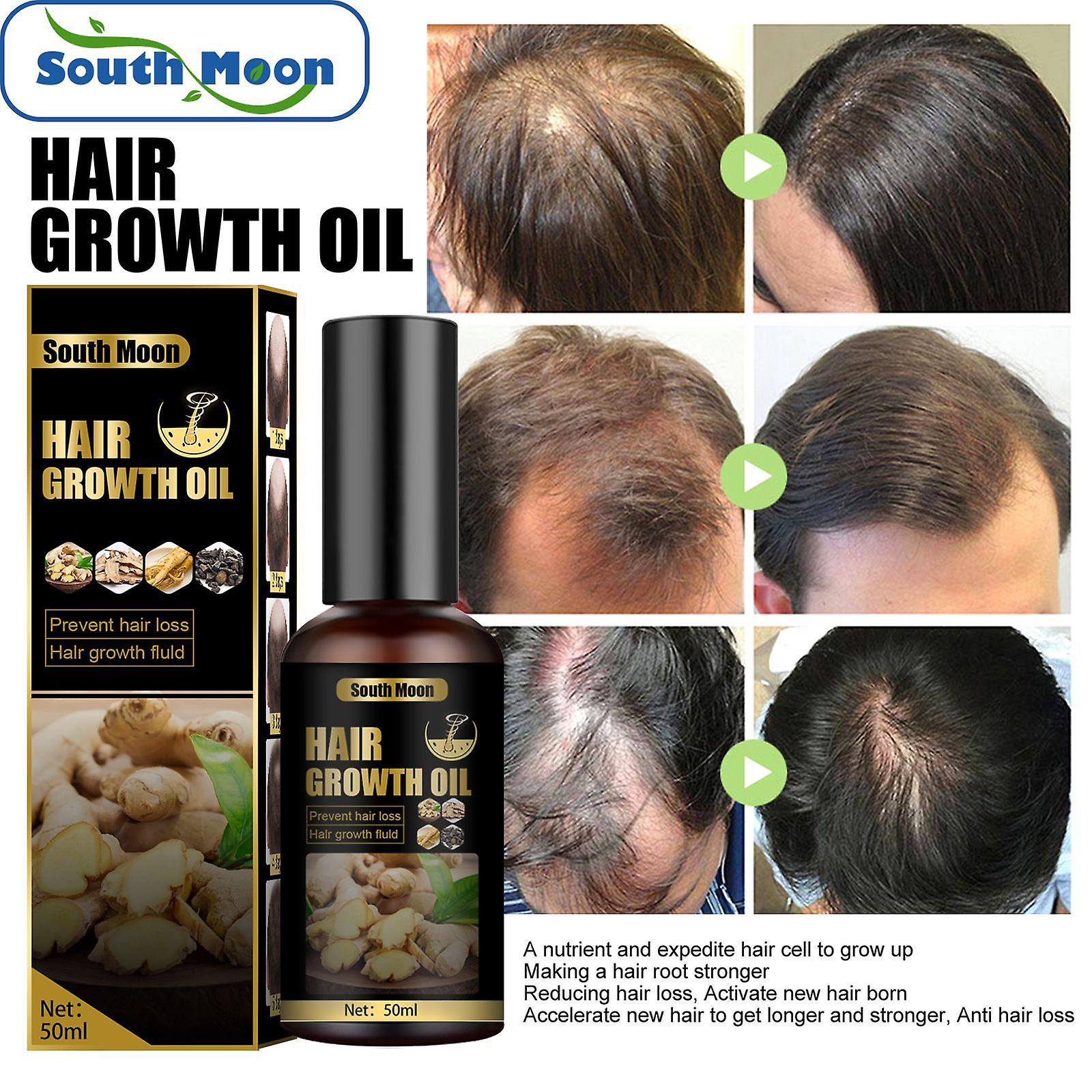 Prevents Hair Growth Fluid Strengthens Hair Thickens Hair And Densifies Hair Nutrition Growth Fluid