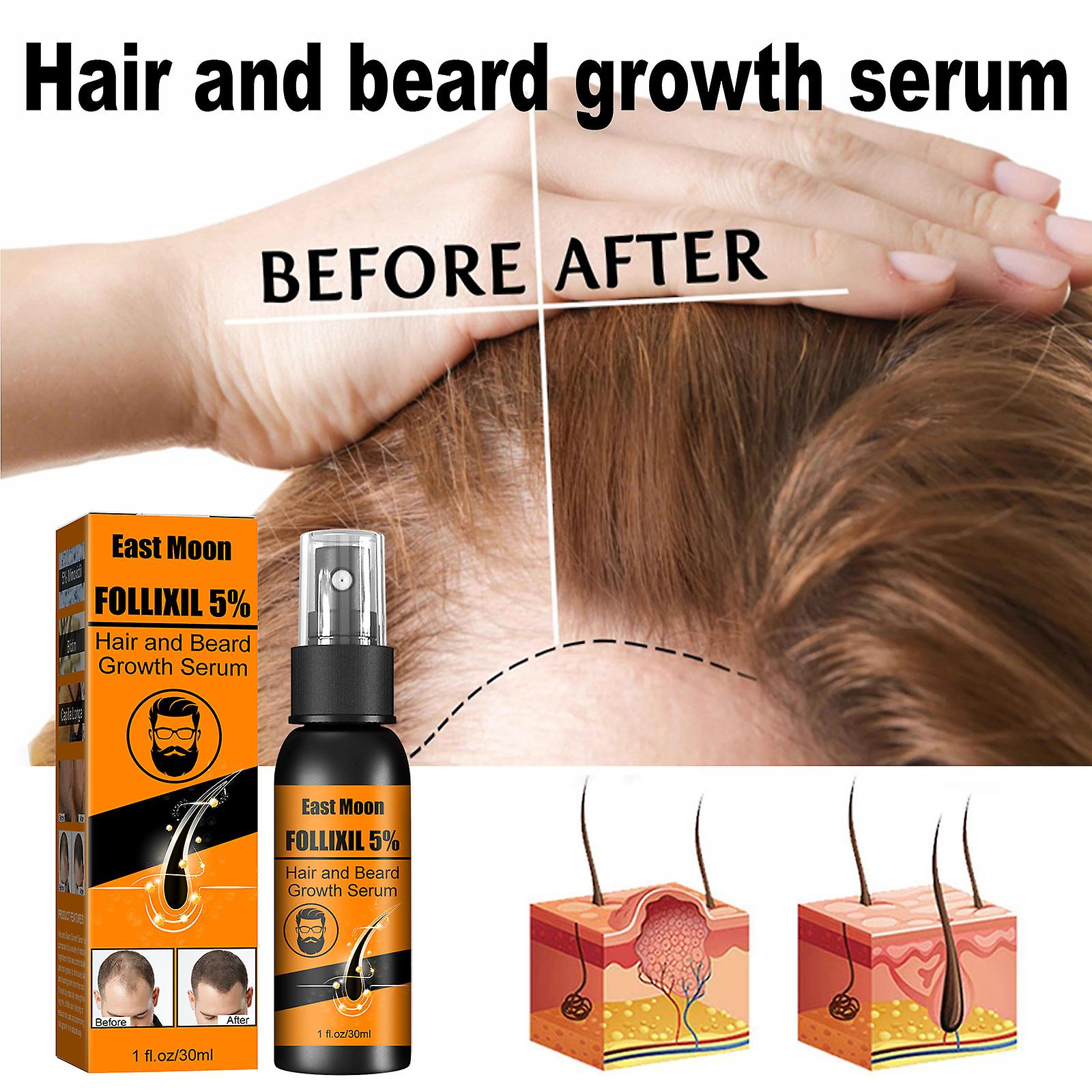 Hair And Beard Growth Serum Beard Hairline Dense Hair To Prevent Nutrient Hair Root Care