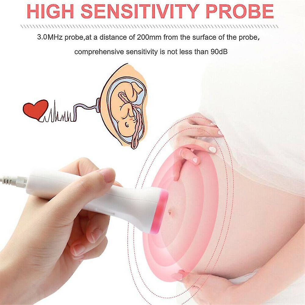 Ultrasound Doppler Fetal Heartbeat Prenatal Heart Rate Monitor Home Use (1pc)