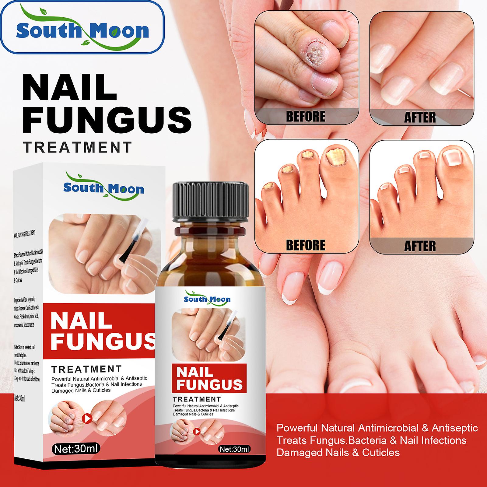 Hand And Foot Nail Repair Solution Nail Fungus Special Treatment Nourishing Smoothing Nails Bright Nail Liquid