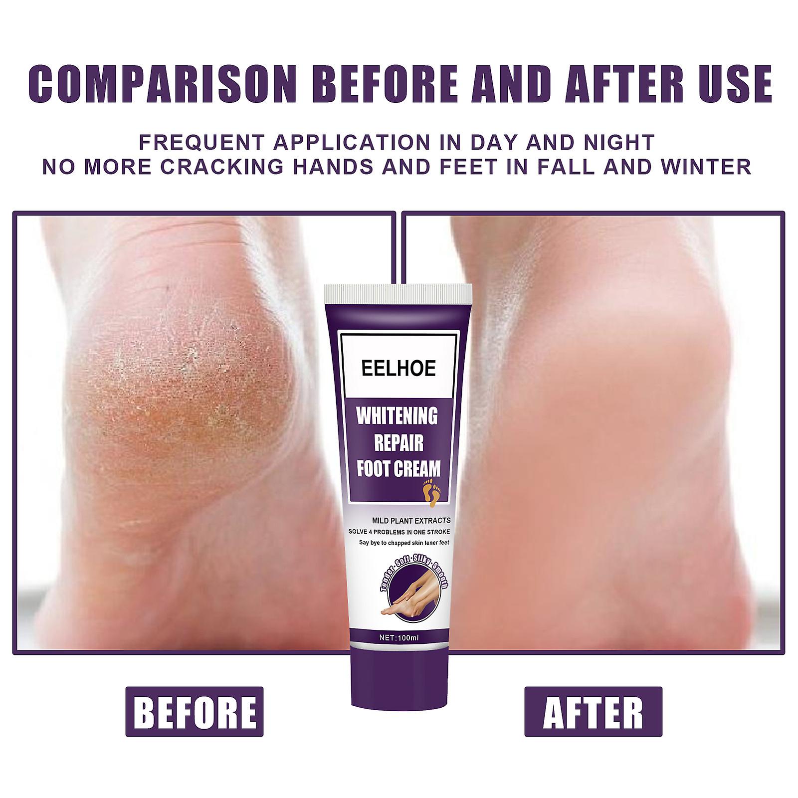 Whitening Repair Foot Cream Moisturizing Moisturizing Exfoliation