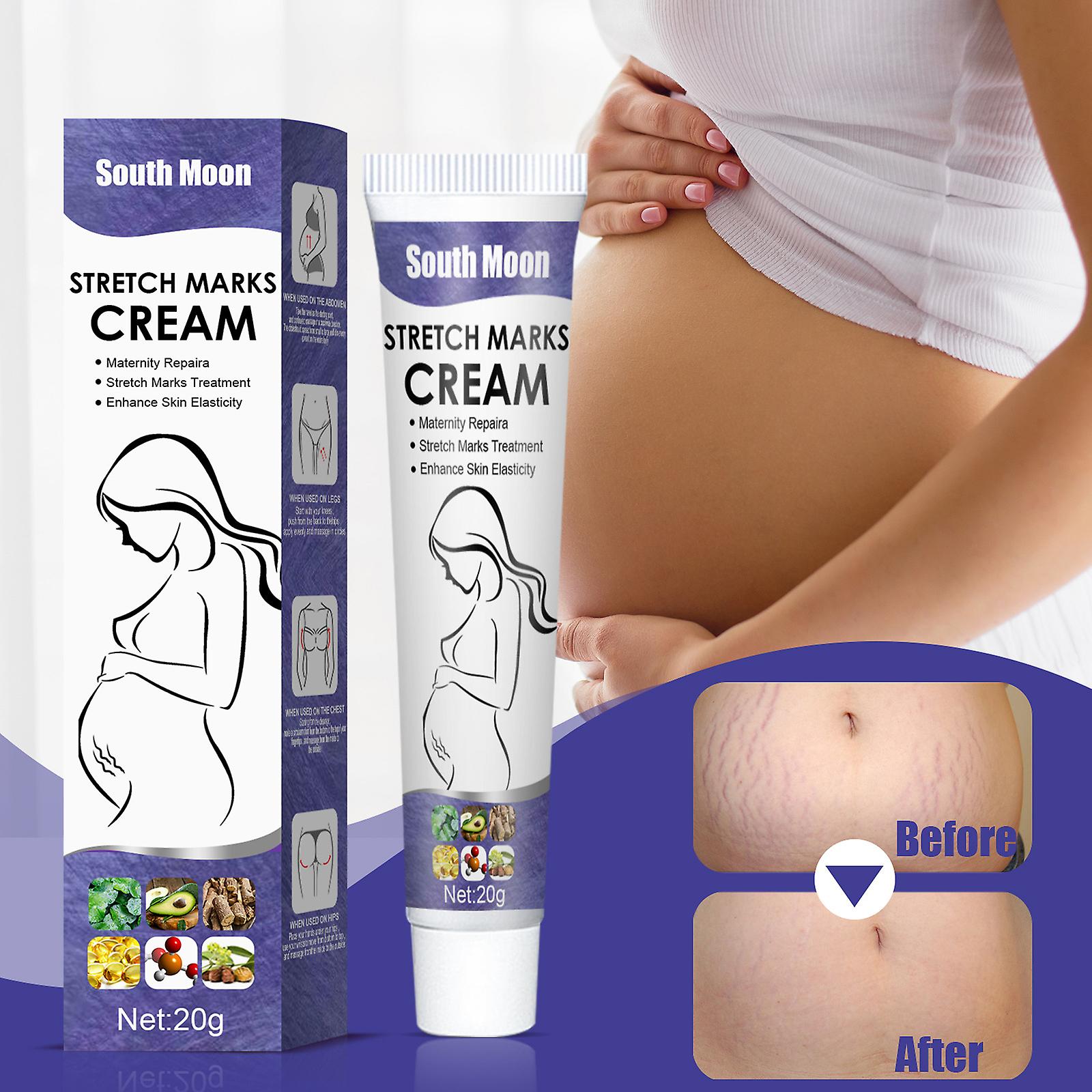 Stretch Mark Repair Cream Postpartum Removal Of Stretch Marks Mommy Cream Lighten Growth Marks Obesity Marks Stretch Marks