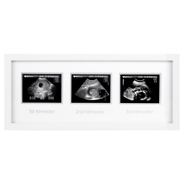 Pearhead Trimester Sonogram Frame White