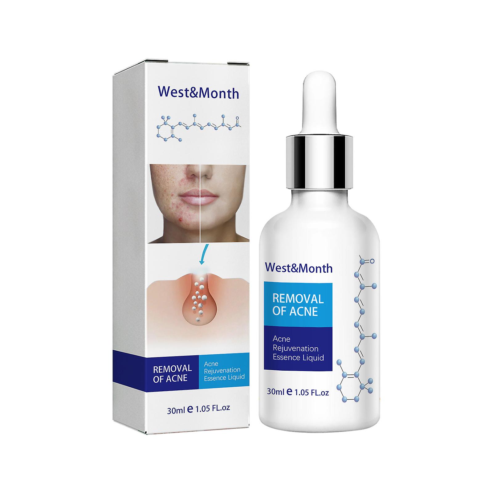 Acne Repair Serum Exfoliating And Closed Blackheads Pore Contraction And Gentle Hydration