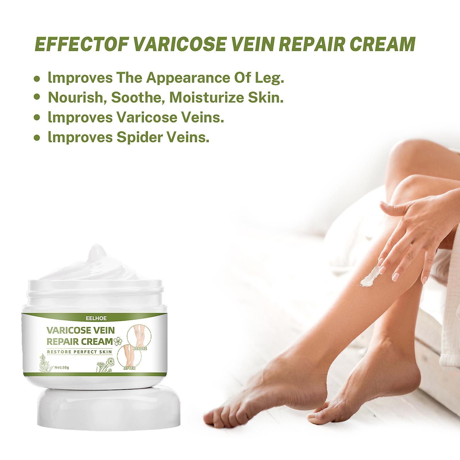 Vein Repair Cream: Massage Legs Relieve Pain Unblock Meridians Venous Relaxation Care Repair Balm