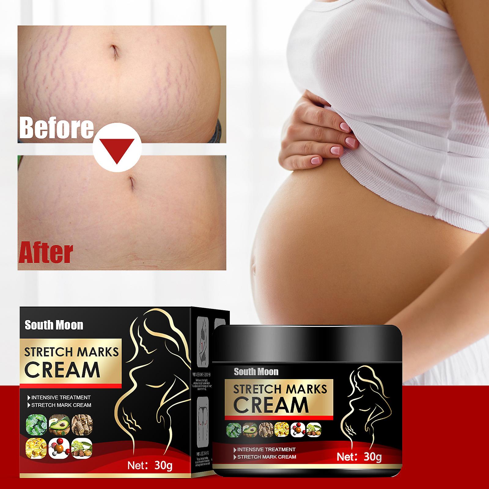 Skin Pregnancy Firming Repair Cream Postpartum Wrinkle Removal Lightening Growth Lines Obesity Lines Wrinkles Repair