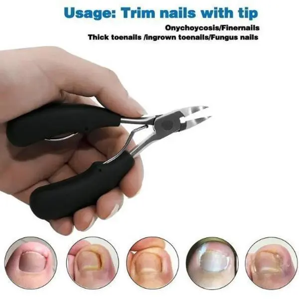 Medical-Grade Nail Clippers