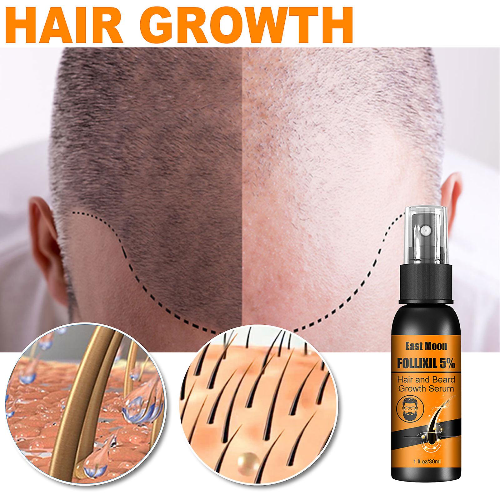 Hair And Beard Growth Serum Beard Hairline Dense Hair To Prevent Nutrient Hair Root Care