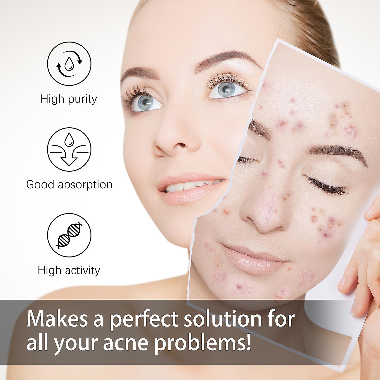 Acne Repair Serum Exfoliating And Closed Blackheads Pore Contraction And Gentle Hydration