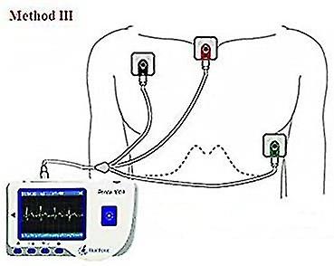 Portable 24-hour Electrocardiograph， Electrocardiograph， Electrocardiogram Monitor， Detector