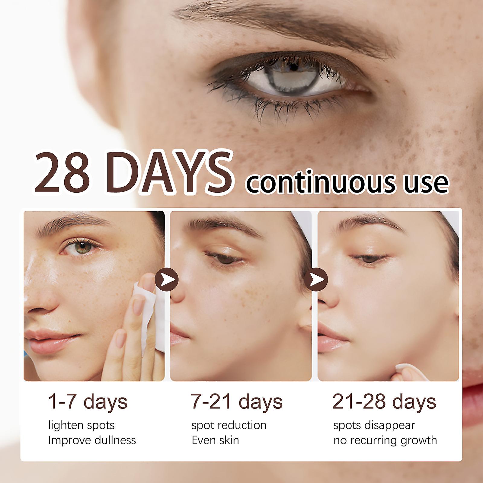 Peel Mask Brightening Mask: Spot Removal Melasma Dark Spots Hydration Moisture And Firmness