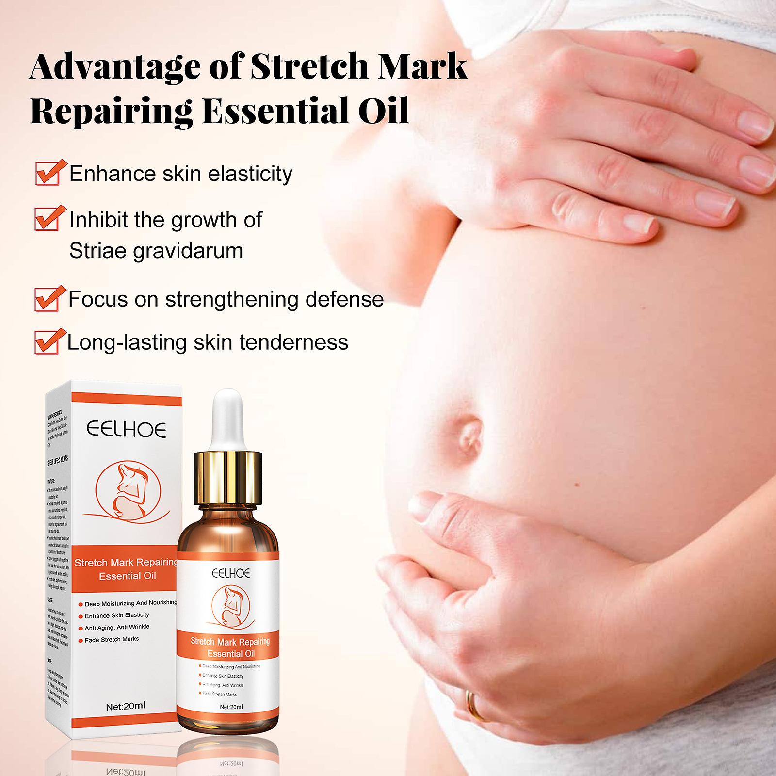 Stretch Mark Repair And Removal Essential Oilspregnant Women Lift Firming Relaxation Line Pregnancy Removal Pregnancy Skin Care