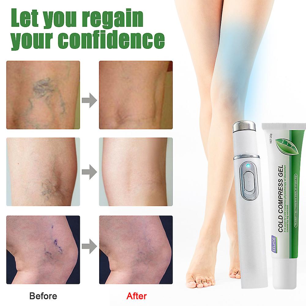 Intravenous Cold Gel Relieves Knee Joint Pain Hand And Leg Massage Leg Relief Leg Varices