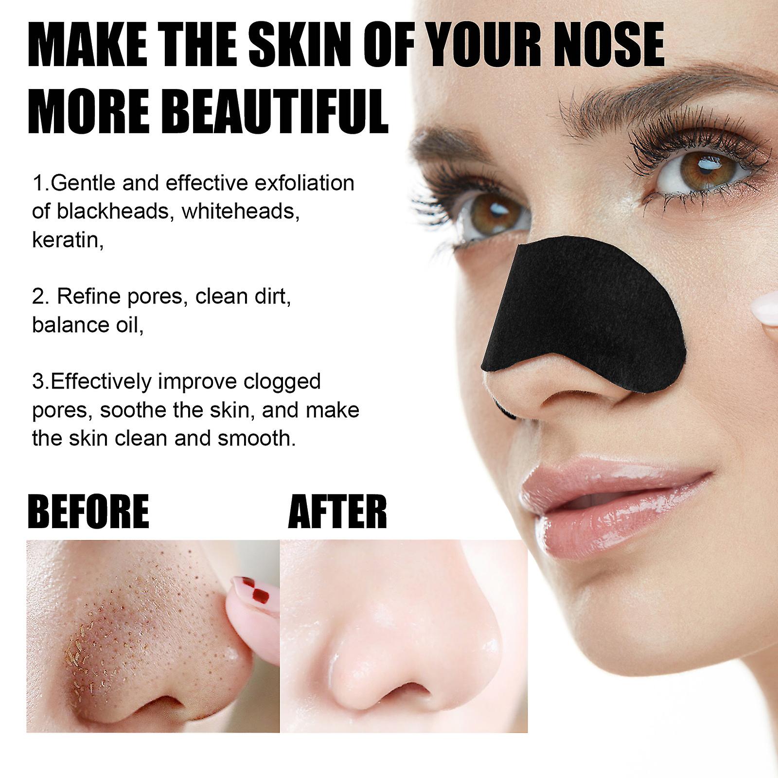 Black Pig Nose Sticker Bamboo Charcoal To Remove Blackheads Nasal Patch Peel Nasal Patch To Remove Acne Set Box To Remove Blackheads