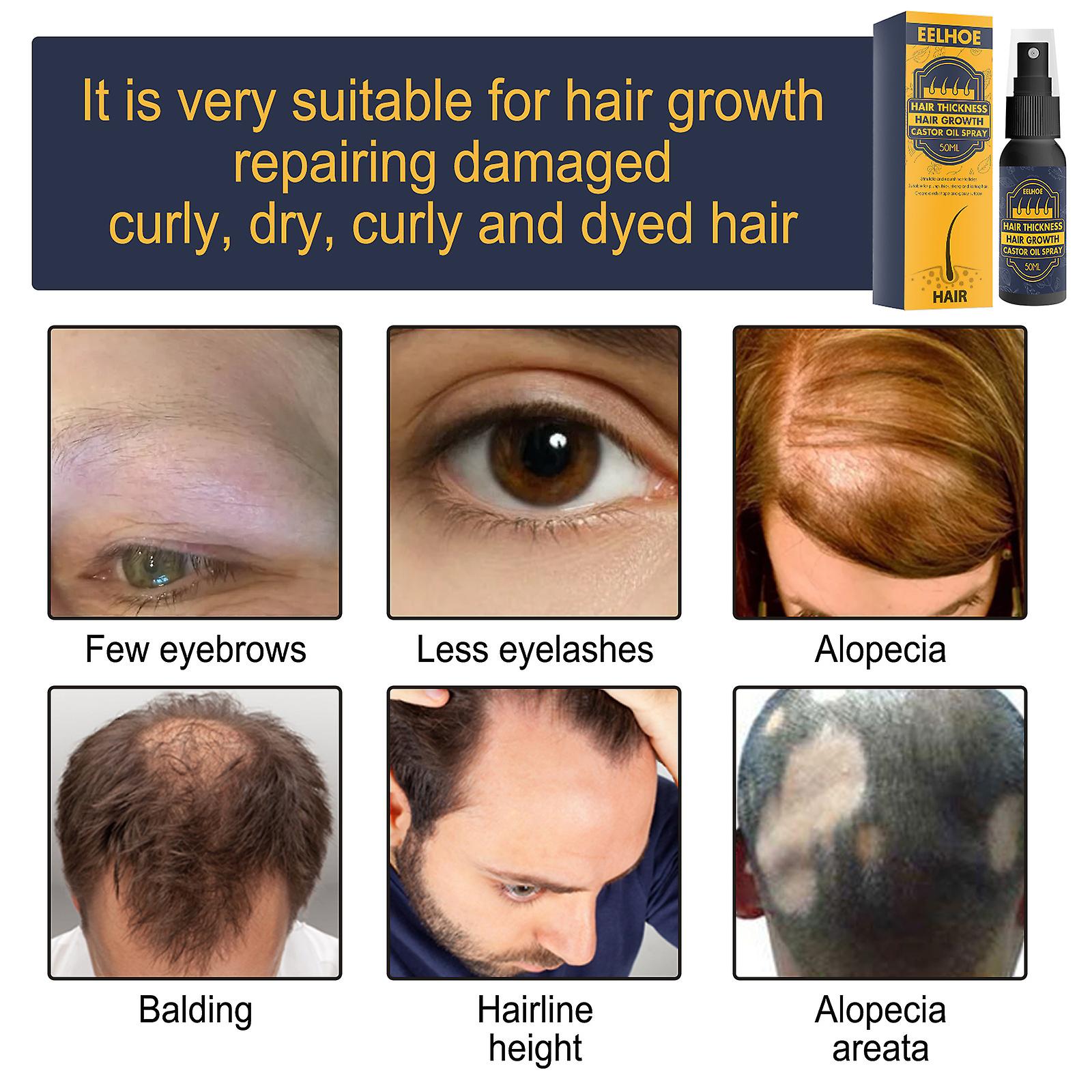 Foreign Trade Cross-border Moisturizing Hair Follicle Castor Oil Hair Growth Hair Moisturizing Hair To Prevent Nutrient Solution