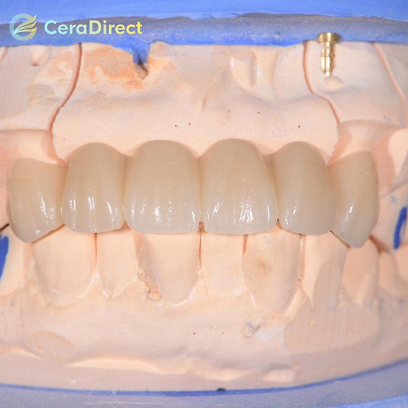 Born Pretty Ceradirect 3d Pro Multilayer Zirconia Open System(98mm) Thickness 20-25mm For Dental Lab