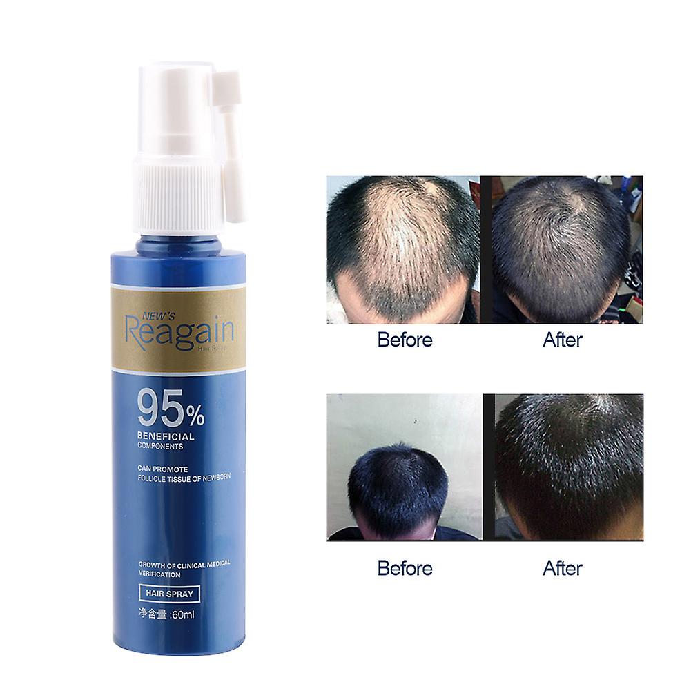 60ml Hair Growth Essence Nourishing Scalp Hair Loss Treatment Liquid Pilatory