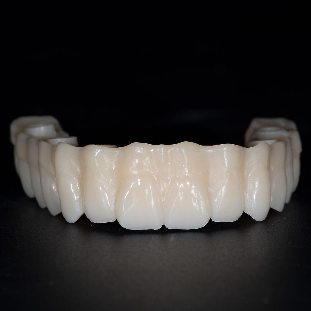 Born Pretty Ceradirect Multilayer Pmma Blockzirkon Zahn(95mm)14mmfor Dental Lab Cad/cam