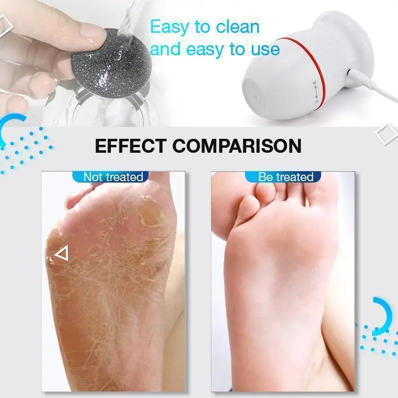 USB Rechargeable Vacuum Adsorption Foot Grinder