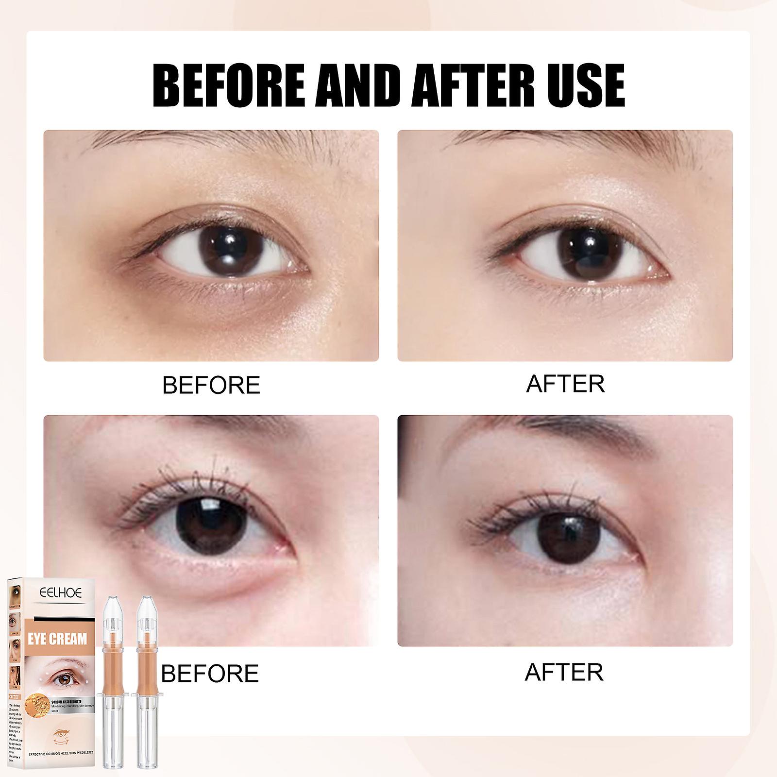 Eye Cream， Lifts Eye Bags， Wrinkles， Lifts， Lightens Dark Circles， Fine Lines， Eye Lines， Eye Serum Product Specification 2pcs-box