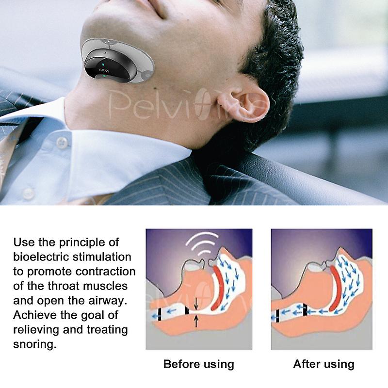 Born Pretty Smart Anti Snoring Device， Most Effective Solution Snore Sleep Stop Snoring Throat Snore，snoring Stopper Anti Snore Nose