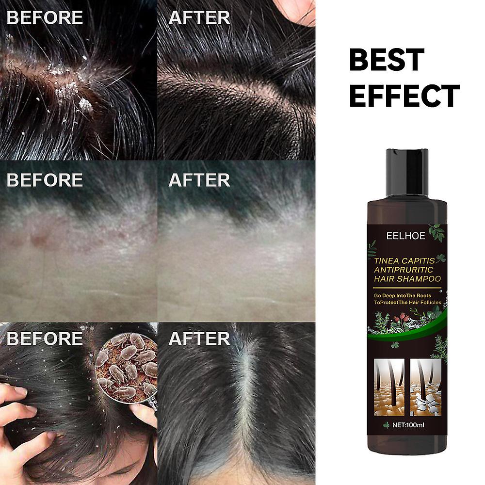 Foreign Trade Cross-border Anti-dandruff Anti-itch Shampoo Deep Cleansing Anti-itch Shampoo Refreshing Oil Removal Shampoo