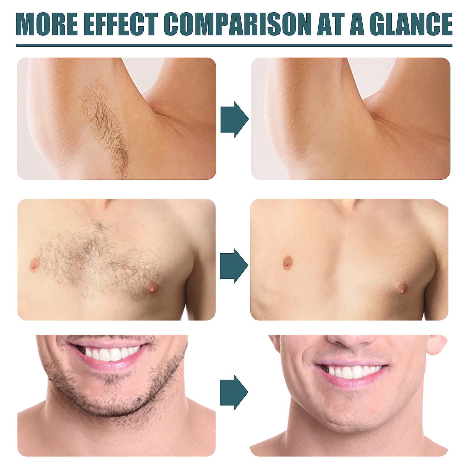 Mens Hair Removal Cream Gentle And Does Not Irritate The Face Beard Armpits Legs And Chest Hair Clean And Does Not Hurt The Skin