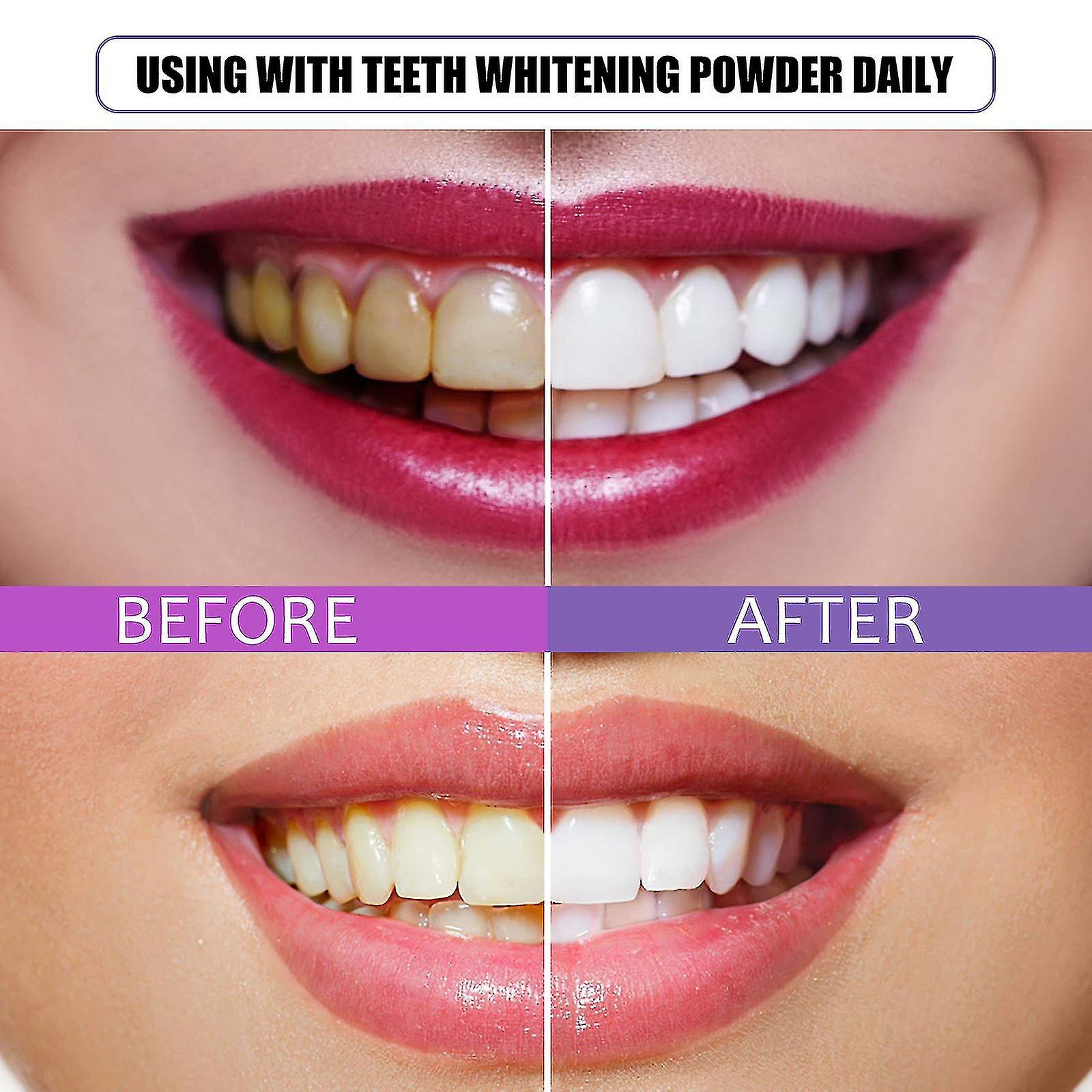 Baking Soda White Teeth Strong Stain Remover Laundry Powder