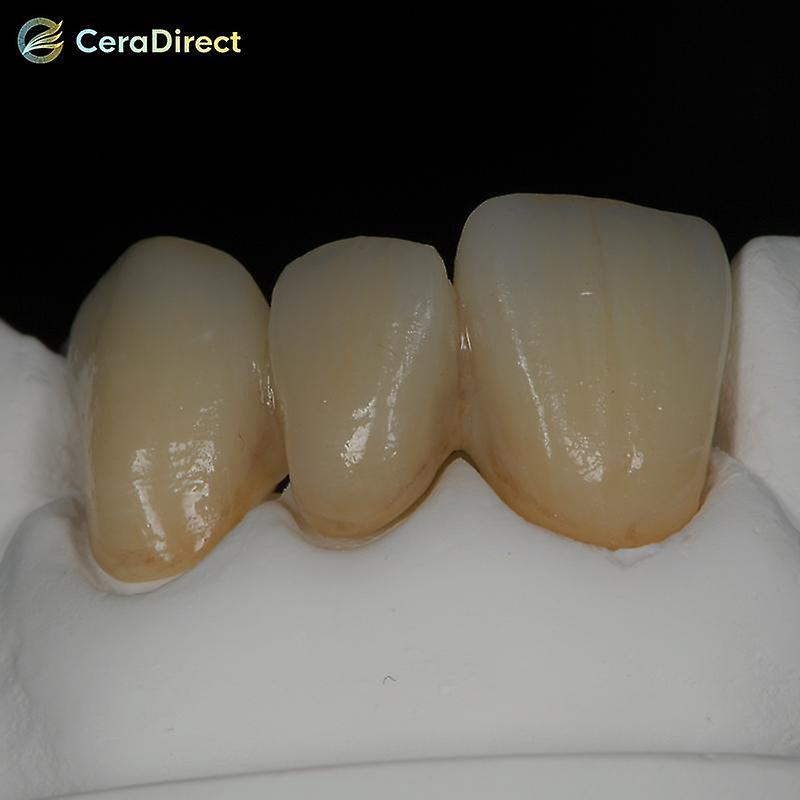 Born Pretty Ceradirect Sht-ml Multilayer Ag System (71mm) Thickness 20mmfor Dental Lab Cad/cam