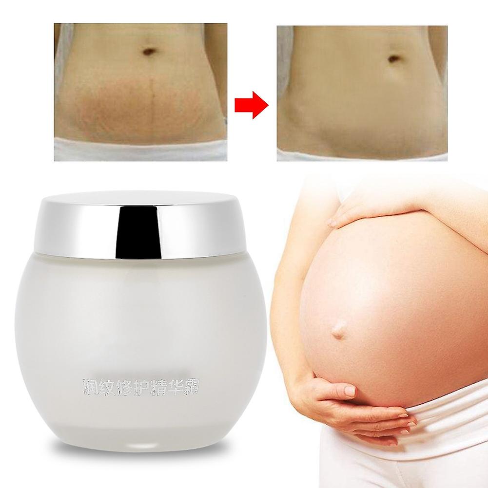 Stretch Mark Removal Repair Body Cream Skin Moisturzing Whitening For Pregnancy Women