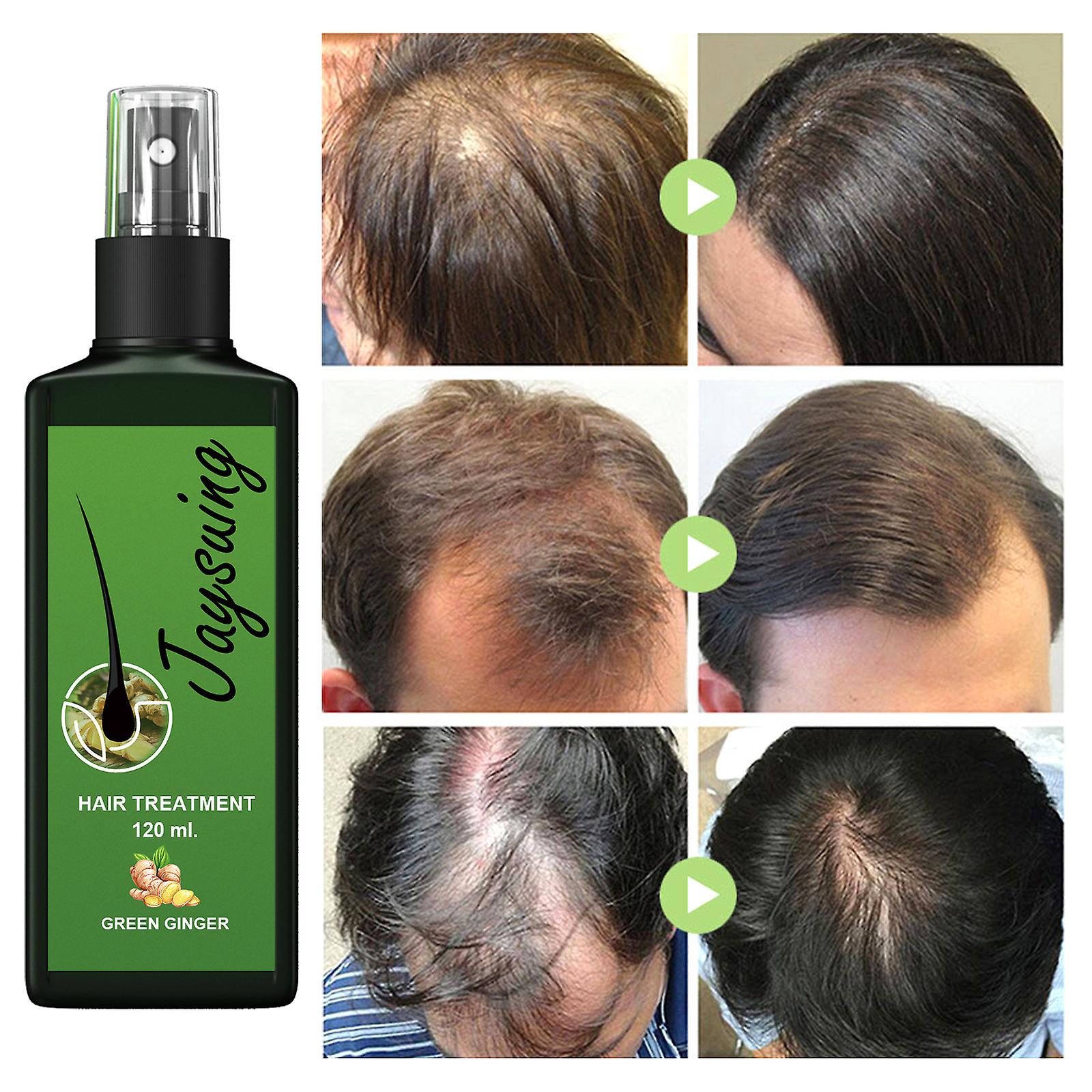 Hair Growth Solution: Strong Hair Nourishing Hair Roots Thick Scalp Massage Nutrient Solution