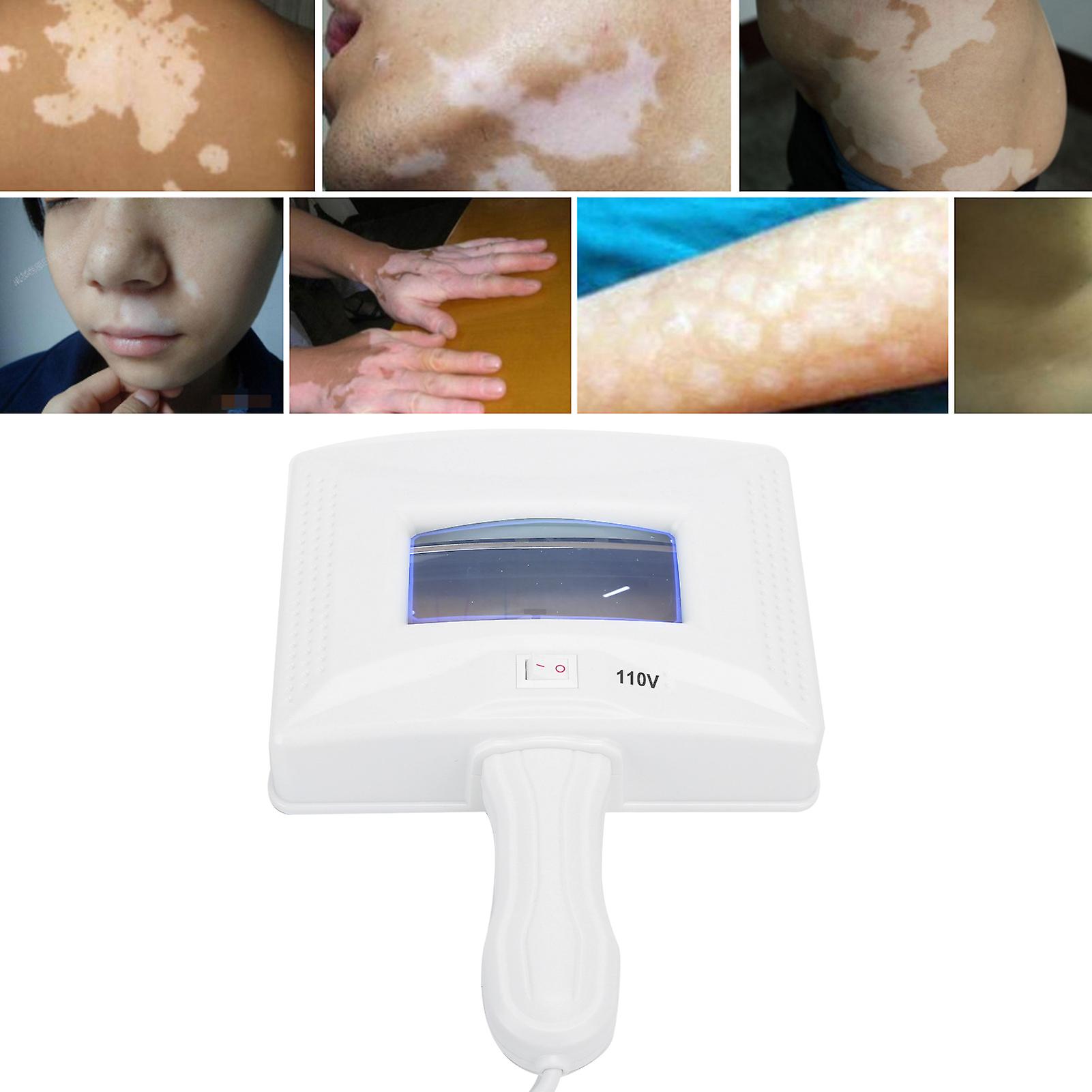 Wood Lamp Skin Analyzer Uv Lamp Device Skin Testing Examination Tool Fungus Test Lampus Plug 110v