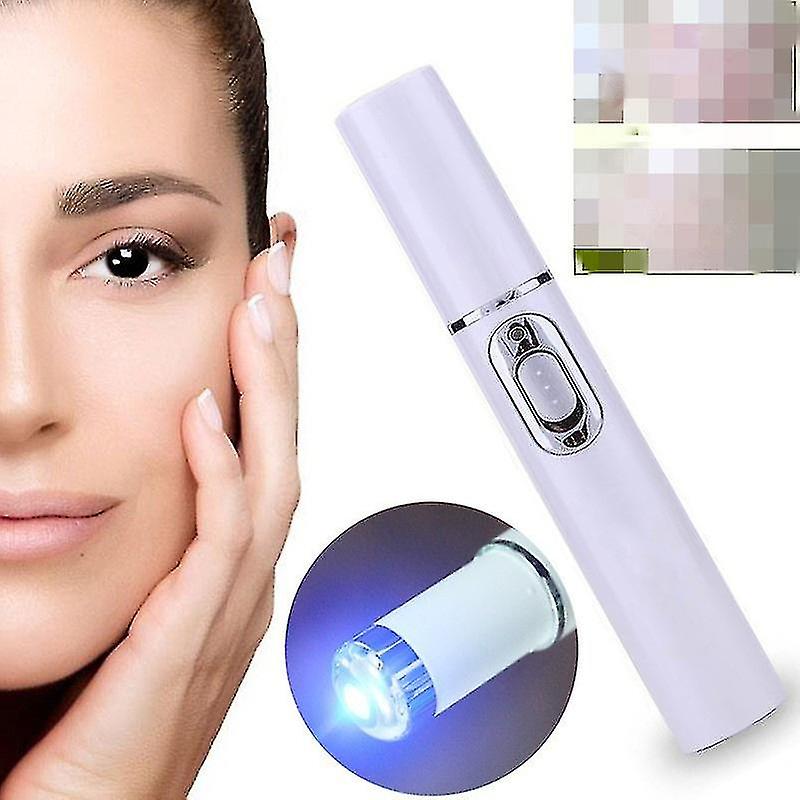 Kd-7910 Eye Massager For Reducing Eye Bags And Dark Circles With Blue Light Acne Removal Pen