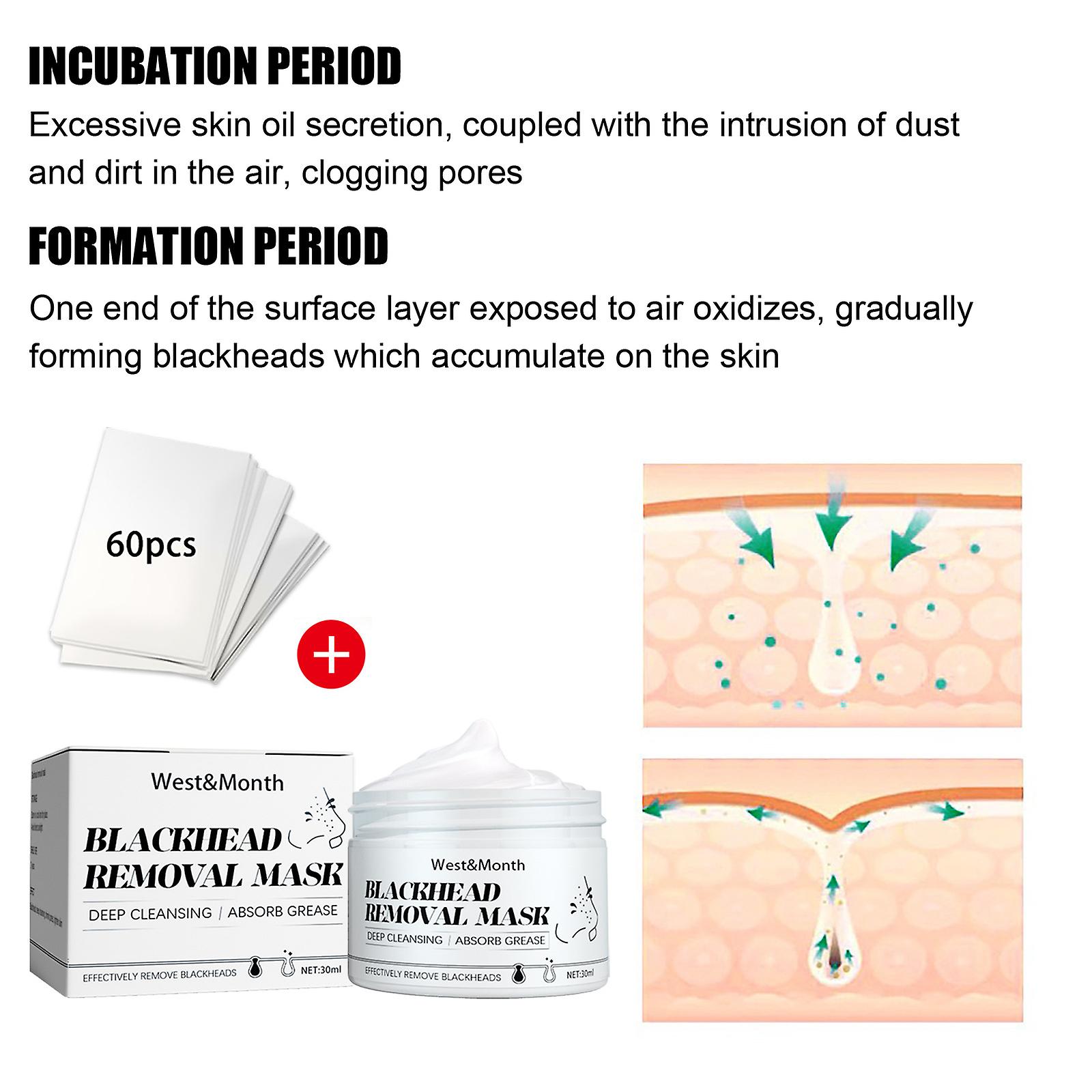 Peelable Blackheads Nasal Membrane T-zone Care Acne Removal Blackheads Shrinkage Pores Nasal Patches