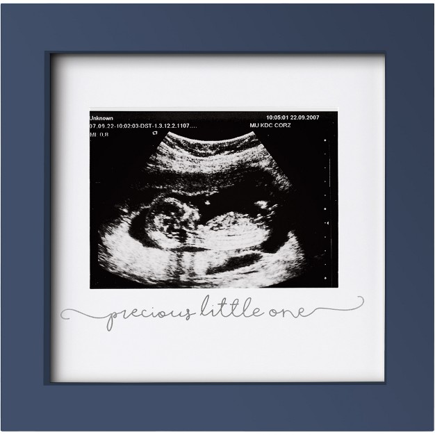 Keababies Solo Baby Sonogram Picture Frame Modern Ultrasound Picture Frames Pregnancy Announcements Sonogram Frame