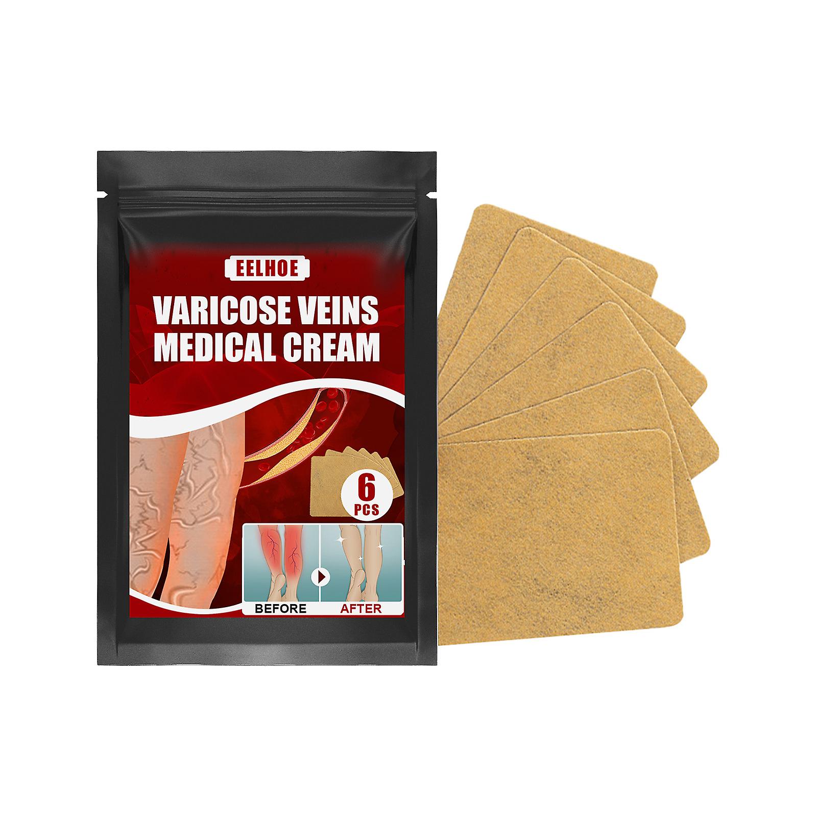 Intravenous Massage Varicose Plaster Patch Swollen Legs Earthworm Legs Intravenous Massage To Relieve Pain