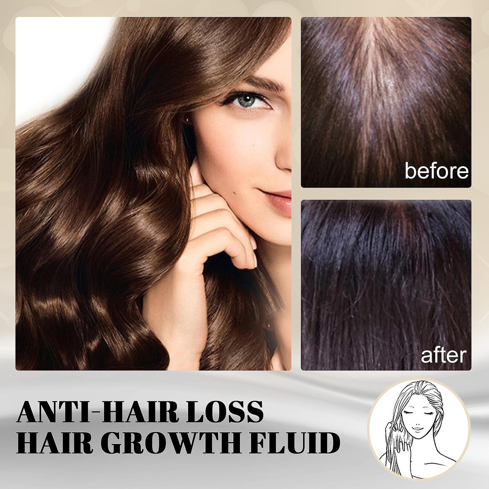 Hair Growth Prevention Hair Growth Nutrition Hair Root Massage Scalp Hair Follicle Damage Repair Strong Hair